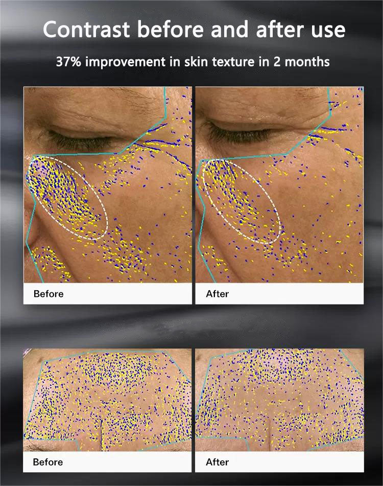 ENVIG EDGE RF beauty instrument myernk